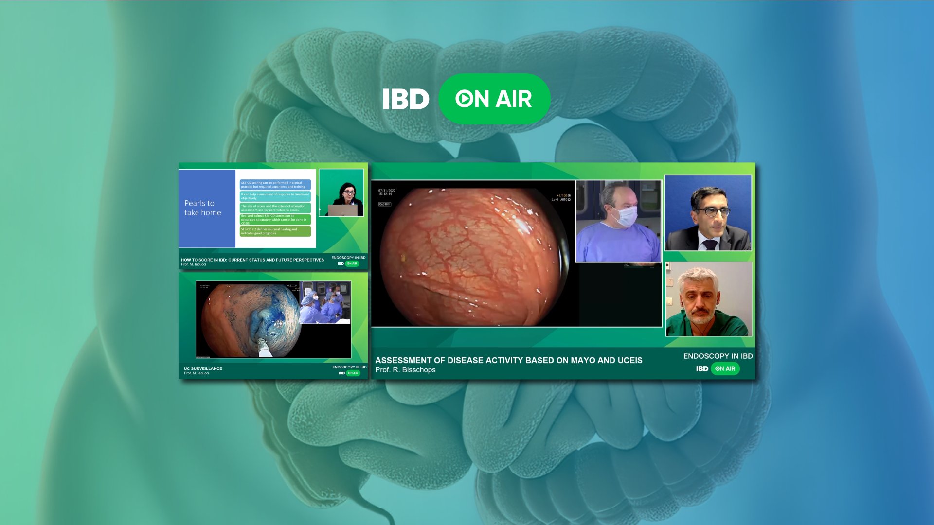 Endoscopy in IBD Endoscopy On Air