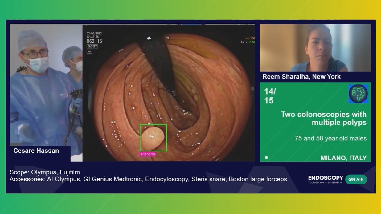 colonoscopy-and-polypectomy-endoscopy-on-air